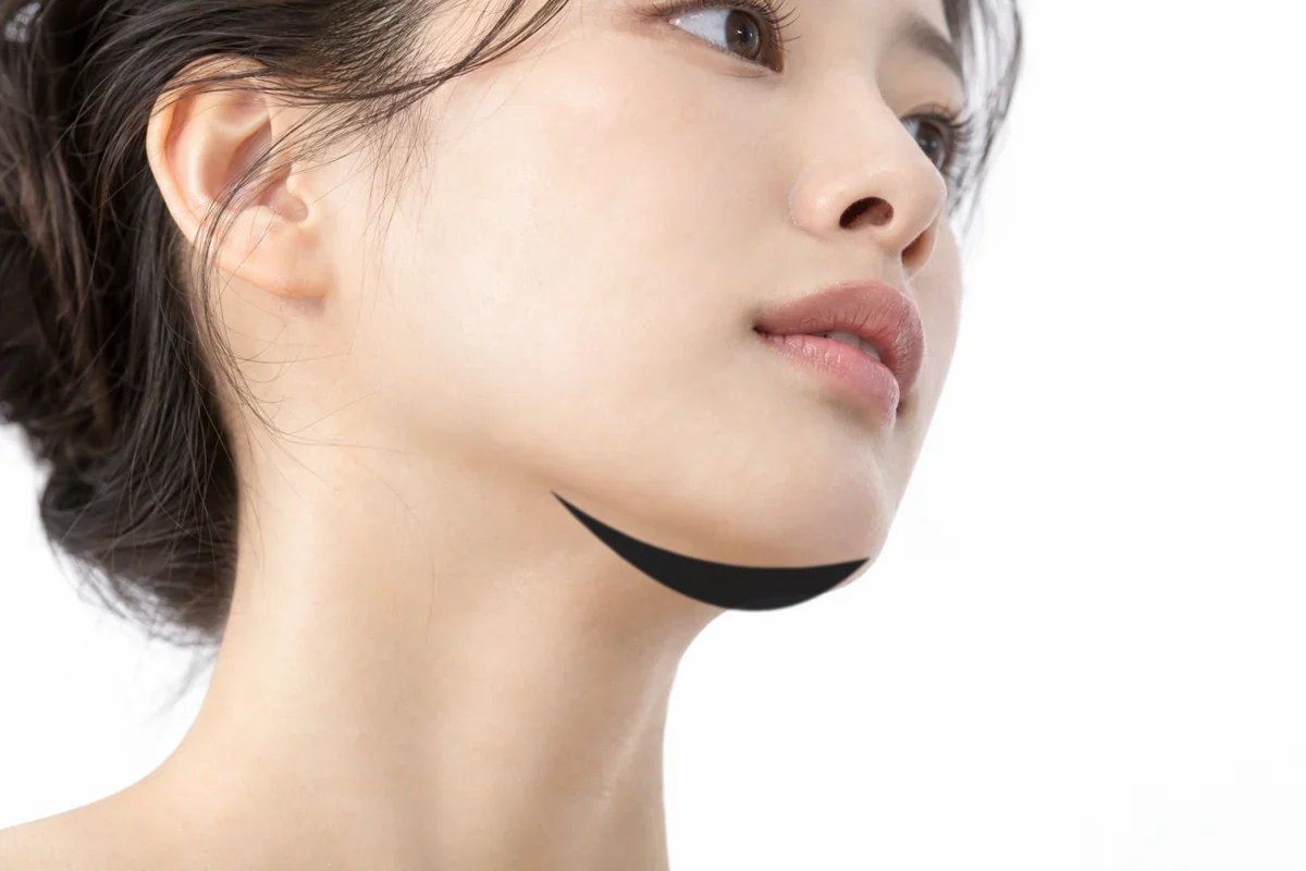 벨루티 브이 적용 부위 — 턱선