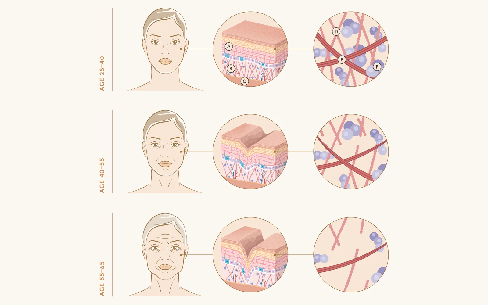 나이대별 얼굴 · 피부 단면 · 콜라겐 구조의 변화를 나란히 보여 주는 엘란쎄 도식
