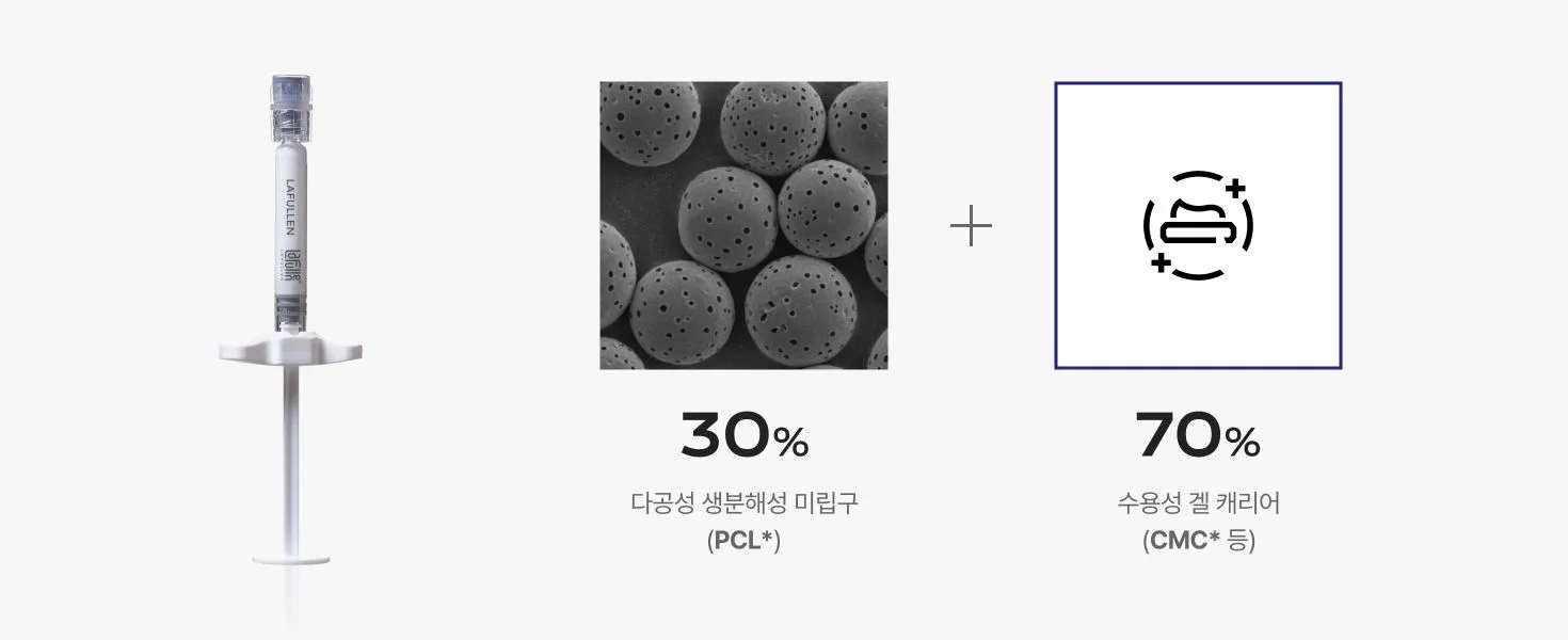 30% 미립구 + 70% 겔 캐리어 구성