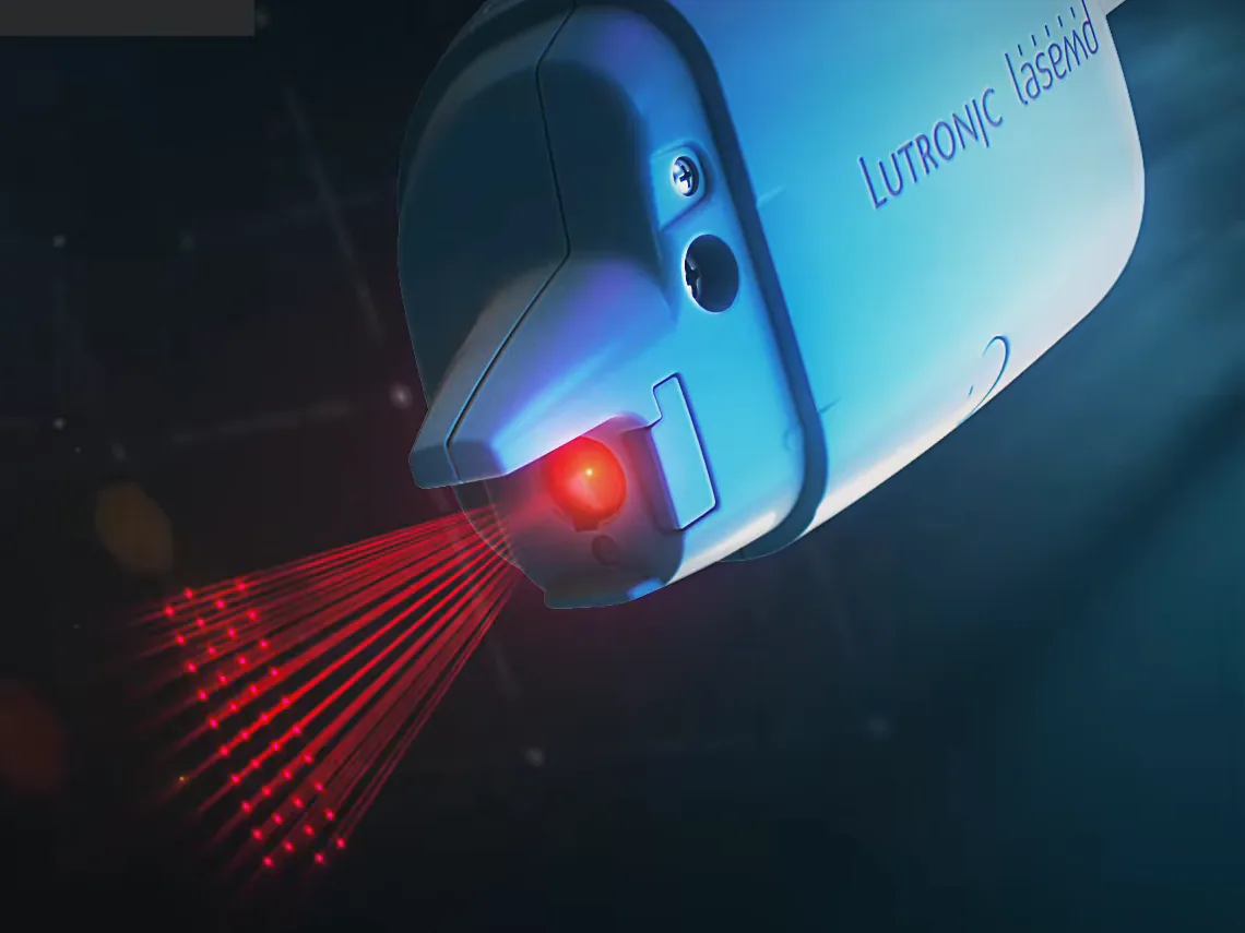 라셈드 핸드피스에서 나오는 레이저 일러스트 · Lutronic 제공