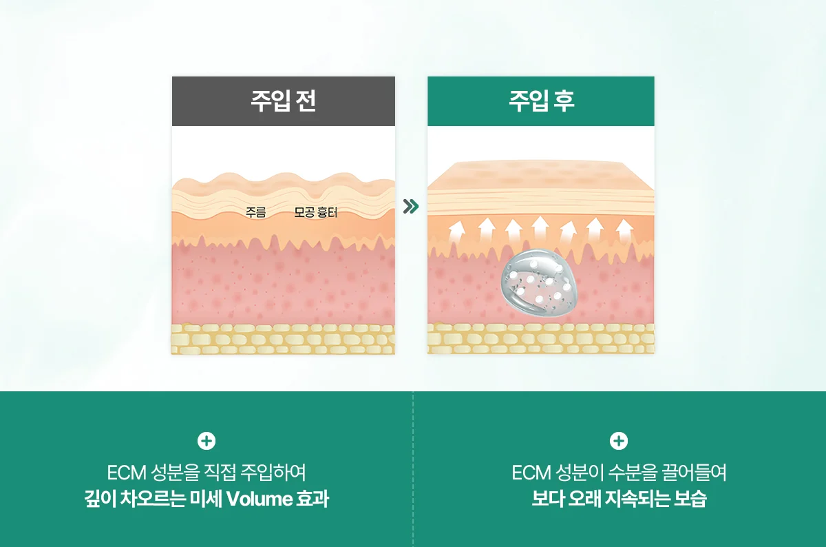 ECM 보충 도식