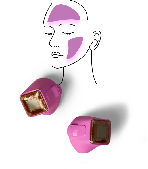 써마지 FLX 4.0cm² 토탈 팁과 얼굴 시술 부위