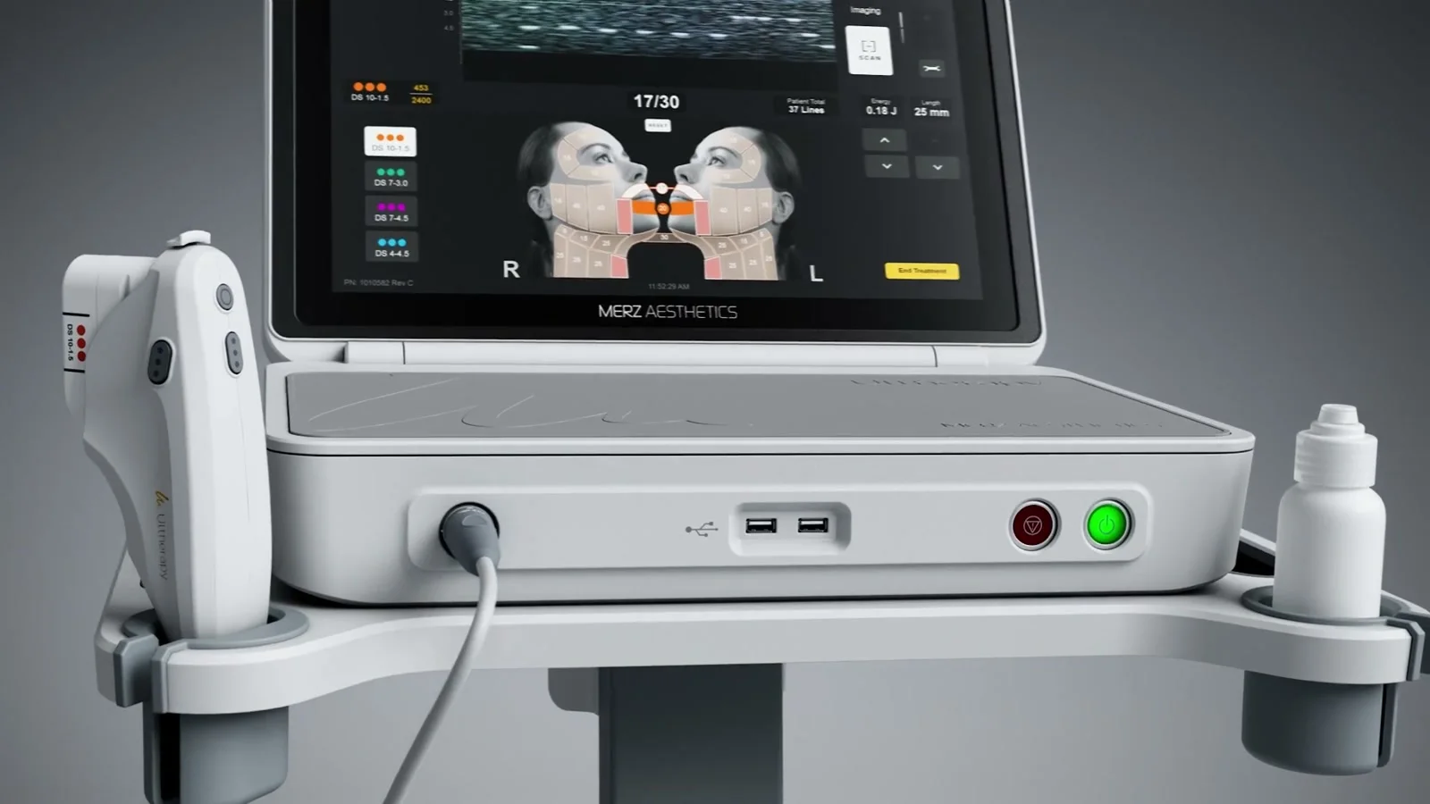 Ultherapy PRIME 設備
